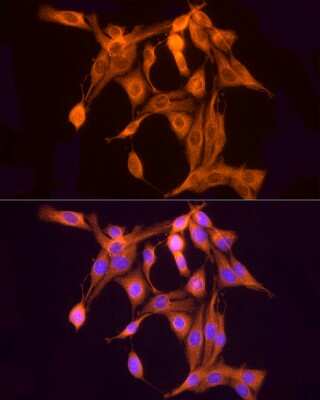 Immunocytochemistry/ Immunofluorescence: ULBP-2 Antibody - Azide and BSA Free [NBP2-94589]